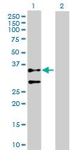 Anti-ACTG2 Rabbit Polyclonal Antibody