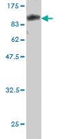 Anti-CAMKK1 Mouse Monoclonal Antibody [clone: 1F6]