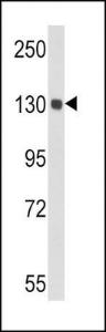 Anti-CP Rabbit Polyclonal Antibody