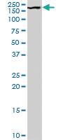 Anti-GRIN2B Goat Polyclonal Antibody