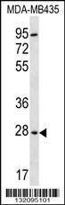 Anti-BPGM Rabbit Polyclonal Antibody (AP (Alkaline Phosphatase))