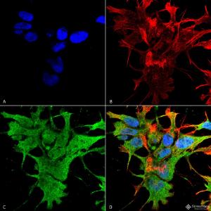 Anti-Dicer Mouse Monoclonal Antibody [clone: S167-7]