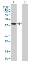 Anti-SDCCAG8 Mouse Polyclonal Antibody