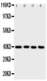 Anti-ATF4 Rabbit Polyclonal Antibody