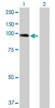 Anti-ACTN4 Rabbit Polyclonal Antibody