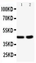 Anti-BCAT1 Rabbit Polyclonal Antibody