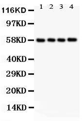 Anti-PKM Rabbit Polyclonal Antibody