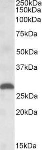 Anti-PLGF Goat Polyclonal Antibody