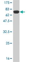 Anti-AGER Mouse Monoclonal Antibody [clone: 1C1]