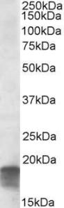 Anti-SDHAF1 Antibody (A84714) (0.3 µg/ml) staining of Human Cerebellum lysate (35 µg protein in RIPA buffer). Primary incubation was 1 hour. Detected by chemiluminescence