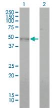 Anti-BMP7 Mouse Monoclonal Antibody [clone: M1-F8]