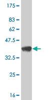 Anti-EIF2AK2 Mouse Monoclonal Antibody [clone: 1D11]