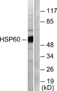 Western blot analysis of lysates from COLO205 cells using Anti-HSP60 Antibody. The right hand lane represents a negative control, where the antibody is blocked by the immunising peptide