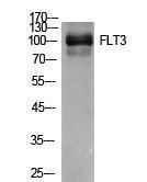 Western blot analysis of extracts from 4T1 cells using Anti-FLT3 Antibody