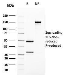 SDS-PAGE analysis of Anti-Uroplakin 1B Antibody [UPK1B/3102] under non-reduced and reduced conditions; showing intact IgG and intact heavy and light chains, respectively. SDS-PAGE analysis confirms the integrity and purity of the antibody.