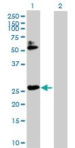 Anti-HOXB7 Rabbit Polyclonal Antibody