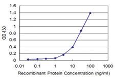 Anti-AATK Mouse Monoclonal Antibody [clone: 2C8]