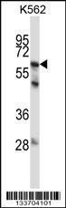 Anti-MMP11 Rabbit Polyclonal Antibody (Biotin)