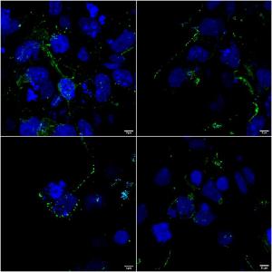 Immunocytochemistry/Immunofluorescence analysis of human COS cells transfected with 2 ug human LRP4 plasmid, fixed in 4% PFA for 10  min, using Anti-LRP4 Antibody [S207-27] (A304980), at 1:100 for 1 hour at room temperature.