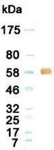 Western blotting result