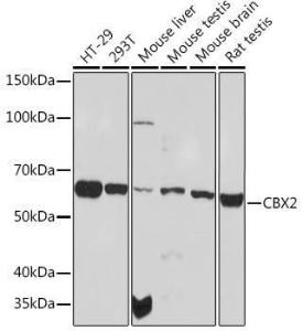 Western blot analysis of extracts of various cell lines, using Anti-CBX2 Antibody [ARC1939] (A306110) at 1:1,000 dilution. The secondary antibody was Goat Anti-Rabbit IgG H&L Antibody (HRP) at 1:10,000 dilution.