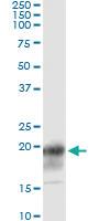 Anti-CD247 Antibody Pair