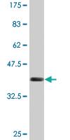 Anti-CAMKK1 Mouse Monoclonal Antibody [clone: 4B4]