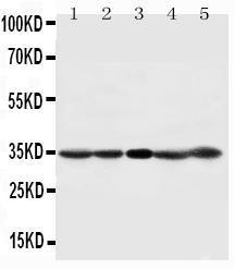 Anti-CDK1 Rabbit Polyclonal Antibody