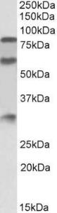 Anti-KNG1 Antibody (A83121) (0.3µg/ml) staining of Human Kidney lysate (35µg protein in RIPA buffer). Primary incubation was 1 hour. Detected by chemiluminescence.