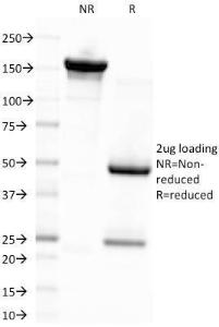 Anti-EBV LMP-1 Mouse Monoclonal Antibody [Clone: CS4]