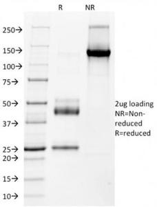 SDS-PAGE analysis of Anti-NKX2.2 Antibody [NX2/1523] under non-reduced and reduced conditions; showing intact IgG and intact heavy and light chains, respectively. SDS-PAGE analysis confirms the integrity and purity of the antibody.