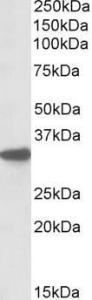 Anti-Cyb5r3 Antibody (A84717) (0.1µg/ml) staining of Mouse Liver lysate (RIPA buffer, 35µg total protein per lane). Primary incubated for 1 hour. Detected by western blot using chemiluminescence.