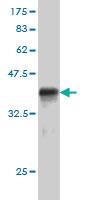 Anti-RACGAP1 Mouse Monoclonal Antibody [clone: 1G6]