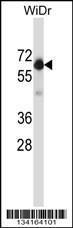 Anti-BECN1 Rabbit Polyclonal Antibody