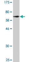 Anti-AGER Mouse Monoclonal Antibody [clone: 1C1]