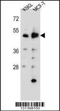 Anti-DNPEP Rabbit Polyclonal Antibody (HRP (Horseradish Peroxidase))