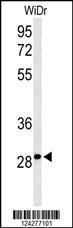 Anti-NMRK1 Rabbit Polyclonal Antibody (Biotin)