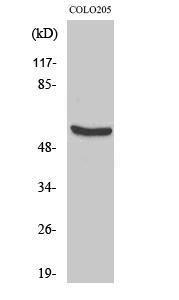 Western blot analysis of COLO205 cells using Anti-HSP60 Antibody