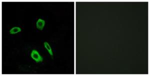 Immunofluorescence analysis of LOVO cells using Anti-EDG7 Antibody. The right hand panel represents a negative control, where the antibody was pre-incubated with the immunising peptide.