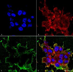 Immunocytochemistry/Immunofluorescence analysis of human neuroblastoma cell line (SK-N-BE, fixed in 4% formaldehyde for 15  min at room temperature, using Anti-LRP4 Antibody [S207-27] (A304980), at 1:100 for 60  minutes at room temperature