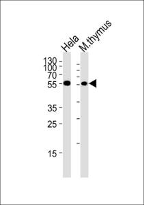 Anti-CHEK1 Rabbit Polyclonal Antibody