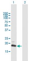 Anti-GUCA1C Mouse Polyclonal Antibody