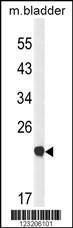 Anti-CLDN23 Rabbit Polyclonal Antibody (APC (Allophycocyanin))