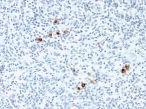 Anti-EBV LMP-1 Mouse Monoclonal Antibody [Clone: CS4]