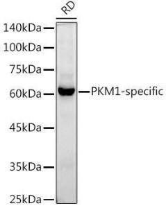 Western blot analysis of extracts of RD cells, using Anti-PKM Antibody [ARC50938] (A306112) at 1:1,000 dilution The secondary antibody was Goat Anti-Rabbit IgG H&L Antibody (HRP) at 1:10,000 dilution Lysates/proteins were present at 25 µg per lane