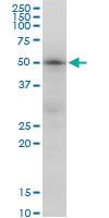 Anti-TUBB2A Mouse Monoclonal Antibody [clone: 3E7]