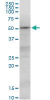 Anti-TUBB2A Mouse Monoclonal Antibody [clone: 3E7]