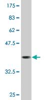 Anti-CAMKK1 Mouse Monoclonal Antibody [clone: 3B4]