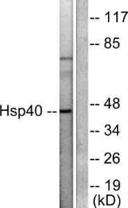 Western blot analysis of lysates from COLO205 cells using Anti-HSP40 Antibody. The right hand lane represents a negative control, where the antibody is blocked by the immunising peptide