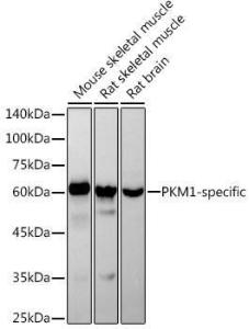 Western blot analysis of extracts of various cell lines, using Anti-PKM Antibody [ARC50938] (A306112) at 1:1,000 dilution The secondary antibody was Goat Anti-Rabbit IgG H&L Antibody (HRP) at 1:10,000 dilution Lysates/proteins were present at 25 µg per lane